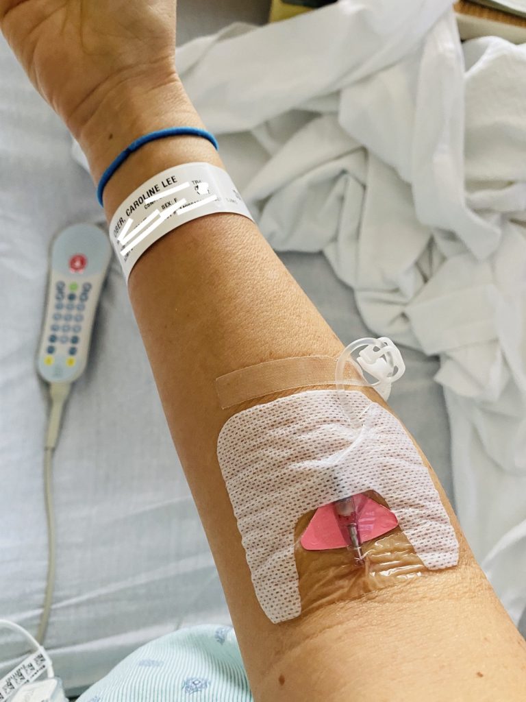 A barcode on my arm is used to keep track of my treatment
